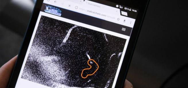 microscope view of squiggle on a cell phone 